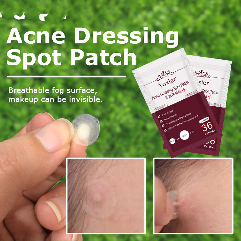 Skin Care Tools Acne Dressing Spot Patchs