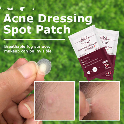 Skin Care Tools Acne Dressing Spot Patchs