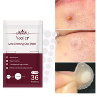 Skin Care Tools Acne Dressing Spot Patchs