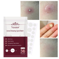 Skin Care Tools Acne Dressing Spot Patchs