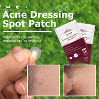 Skin Care Tools Acne Dressing Spot Patchs