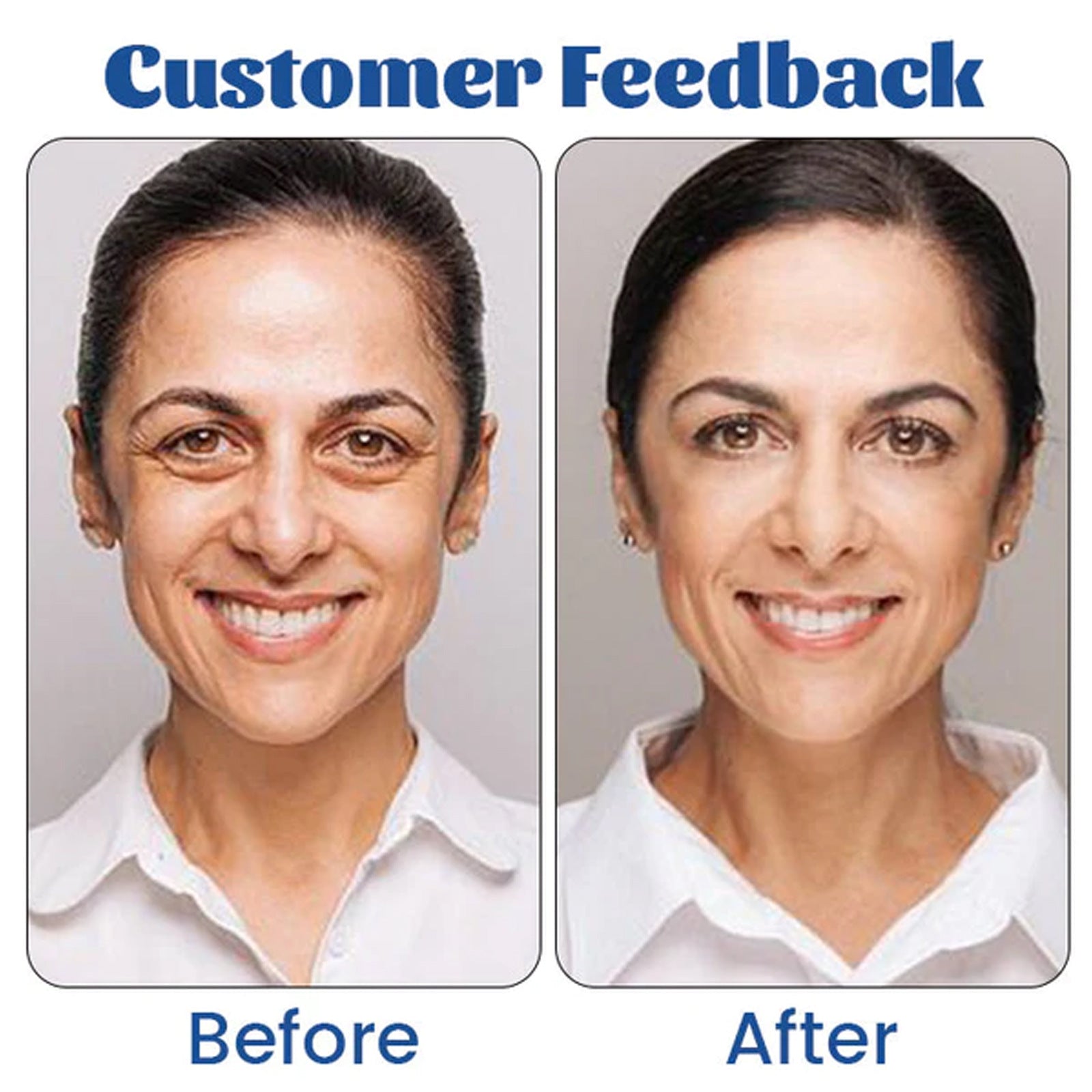 Retinol Eye Cream Fading Wrinkle - Chic Cart AMI Cart