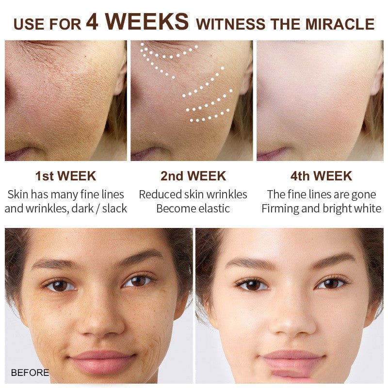 Retinol Compacts To Relieve Aging And Exfoliating Cream - Chic Cart