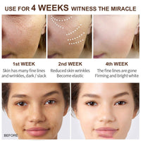 Retinol Compacts To Relieve Aging And Exfoliating Cream - Chic Cart