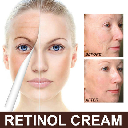 Retinol Hydrating Firming Lifting Brightening Cream - Chic Cart