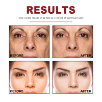 Retinol Facial Fading Wrinkles Hydrating - Chic Cart