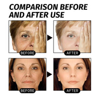 Retinol Gold Facial Mask Deep Pore Cleaning Fading Wrinkle - Chic Cart