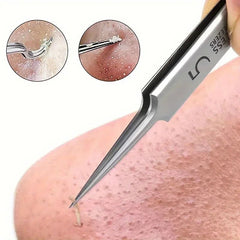 1 Pack Extra Fine No. 5 Cellular Acne Blackhead Tweezers - Facial Beauty Remove Acne Needle Tools for Skin Care - Chic Cart