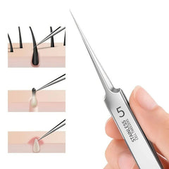 1 Pack Extra Fine No. 5 Cellular Acne Blackhead Tweezers - Facial Beauty Remove Acne Needle Tools for Skin Care - Chic Cart
